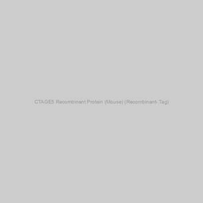 CTAGE5 Recombinant Protein (Mouse) (Recombinant- Tag)